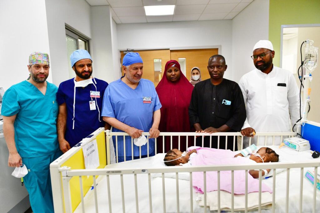 Kano conjoin twins separation successful in Saudi Arabia Surgery